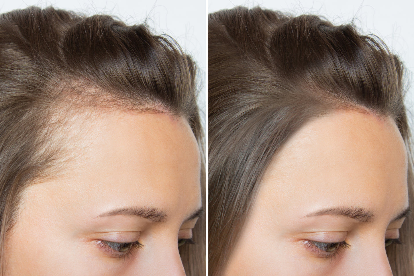 Batana Oil & Rosemary Shampoo for Hair Fall & Regrowth